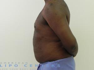 americanlipocenters_197.jpg